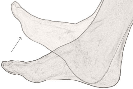 dorsiflexion of the foot image