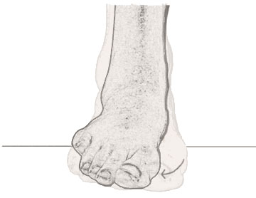 eversion of the foot - image