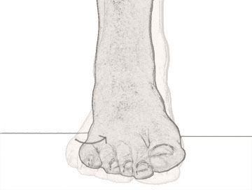 inversion of the foot - image