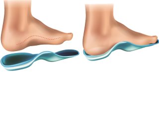 Replacement Insoles and Custom Orthotics.